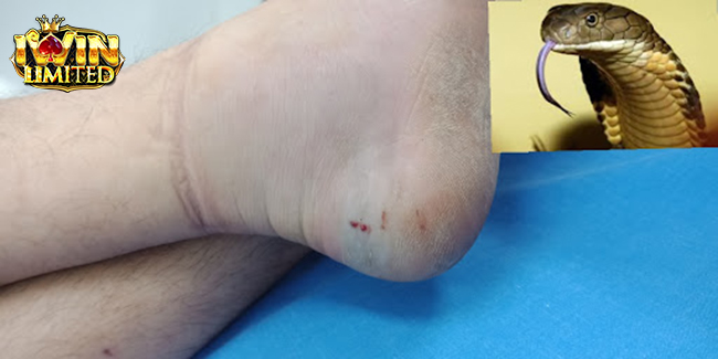 Mơ thấy rắn cắn ngón chân